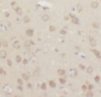 CYBB Antibody