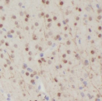 NPAS1 Antibody