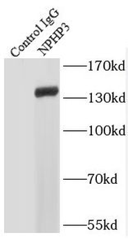 NPHP3 Antibody