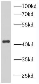 NPHS2 Antibody
