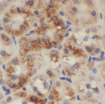 NPHS2 Antibody