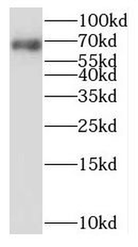 NPLOC4 Antibody