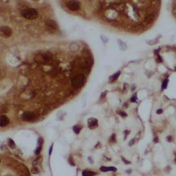 NPLOC4 Antibody