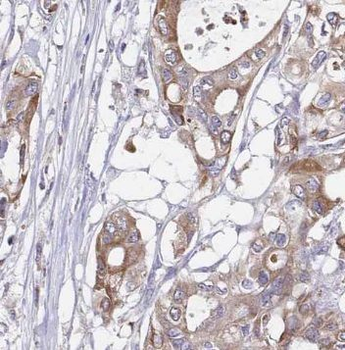 NPTX2 Antibody