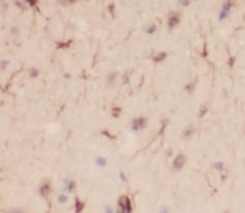NPY Rabbit Polyclonal Antibody