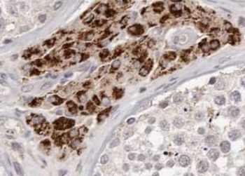NQO2 Antibody