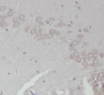GRIN2B Antibody