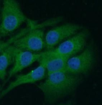 GRIN2B Antibody