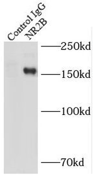 GRIN2B Antibody