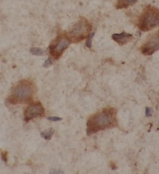 GRIN2B Antibody
