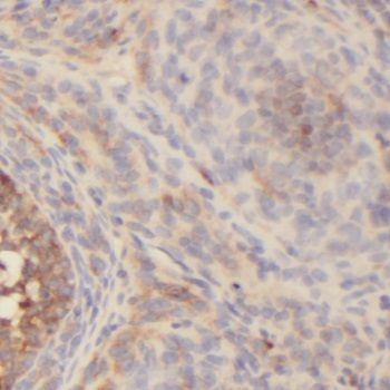 NR2F1 Antibody