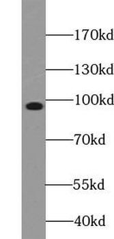 NR3C2 Rabbit Polyclonal Antibody