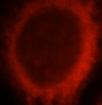 NR3C2 Rabbit Polyclonal Antibody