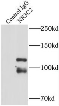 NR3C2 Rabbit Polyclonal Antibody
