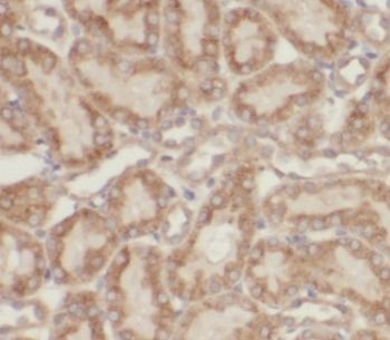 NR3C2 Rabbit Polyclonal Antibody