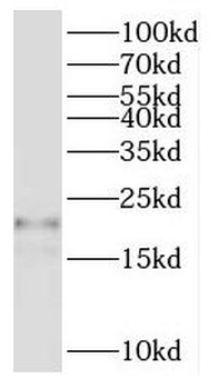 NRAS Rabbit Polyclonal Antibody
