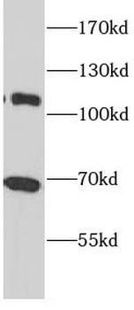 NFE2L2 Rabbit Polyclonal Antibody