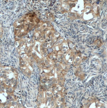 NFE2L2 Antibody