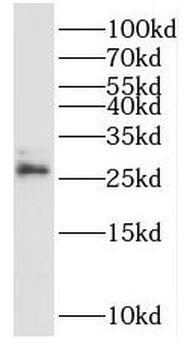 NRIP3 Antibody