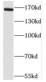 NRXN1 Rabbit Polyclonal Antibody