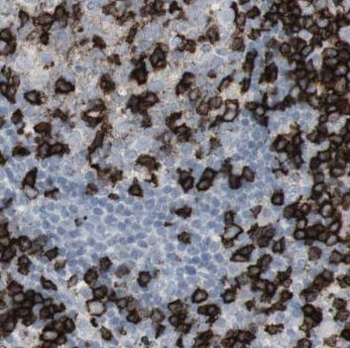 NSD3 Antibody