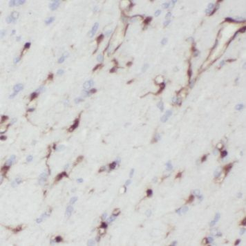 ENO2 Mouse Monoclonal Antibody