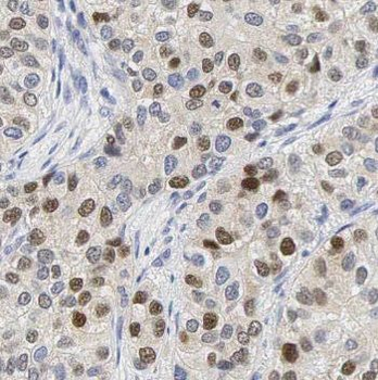 NSUN2 Antibody