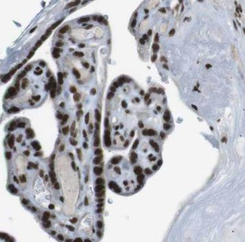 NSUN5 Antibody