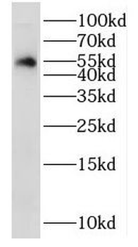 NSUN6 Antibody