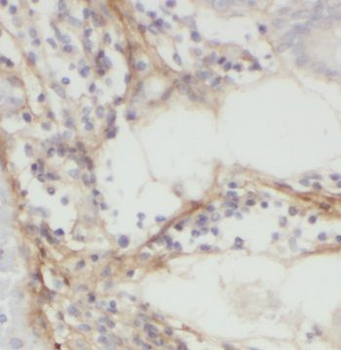 NT5C3A Antibody