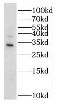 NT5C3B Rabbit Polyclonal Antibody
