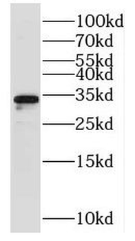 NTHL1 Antibody