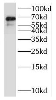NTM Antibody