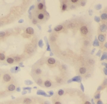 NUAK2 Antibody