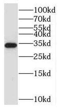 NUBPL Antibody