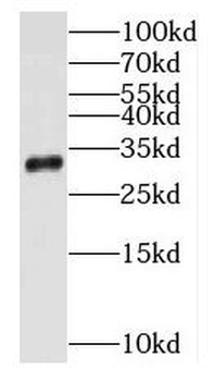 PNP Antibody