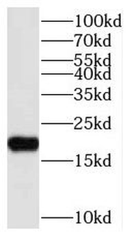 NUDT11 Rabbit Polyclonal Antibody