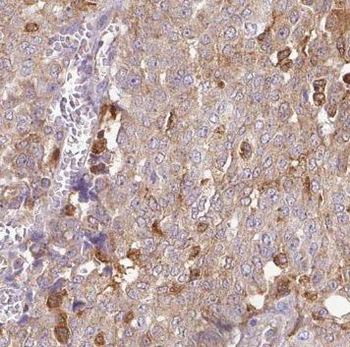 NUDT11 Antibody