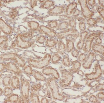 NUDT16 Antibody