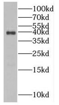 NUDT9 Antibody