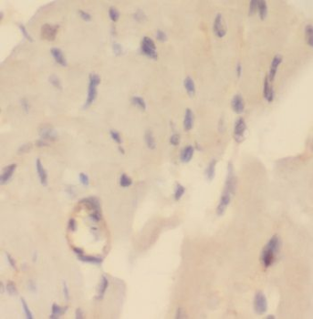 NUDT9 Antibody