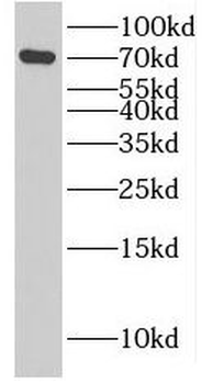 NUMB Rabbit Polyclonal Antibody