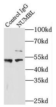 NUMBL Antibody