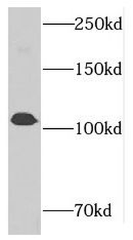NUP107 Rabbit Polyclonal Antibody