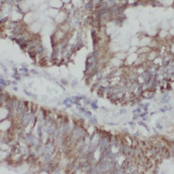 NUP133 Antibody
