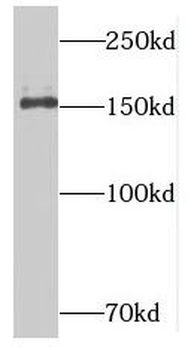 NUP153 Antibody