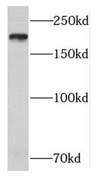 NUP205 Rabbit Polyclonal Antibody