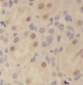 NUP205 Rabbit Polyclonal Antibody