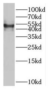 NUP50 Rabbit Polyclonal Antibody