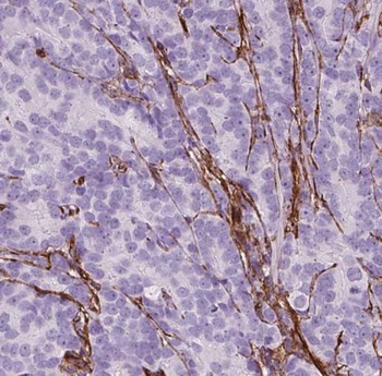 NUSAP1 Antibody
